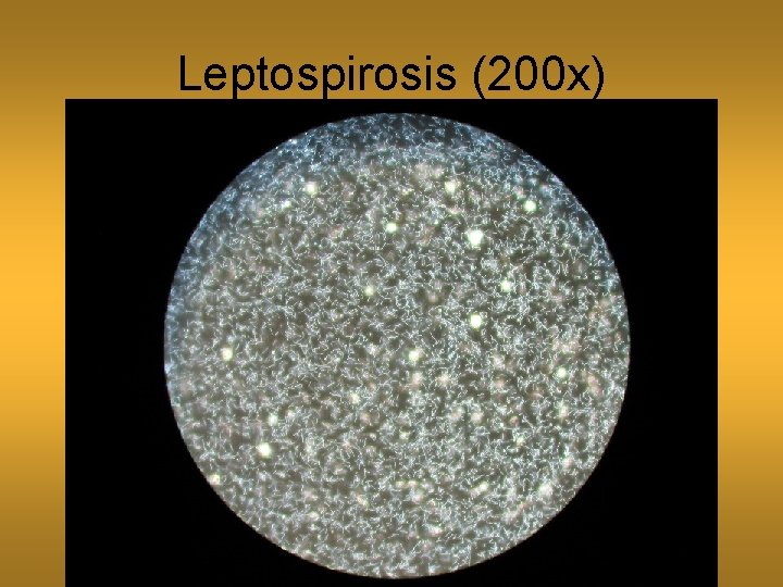 Leptospirosis (200 x) 
