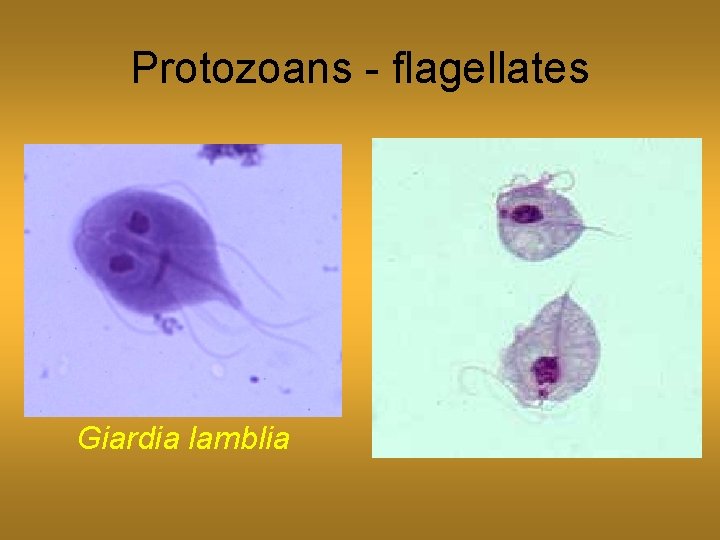 Protozoans - flagellates Giardia lamblia 