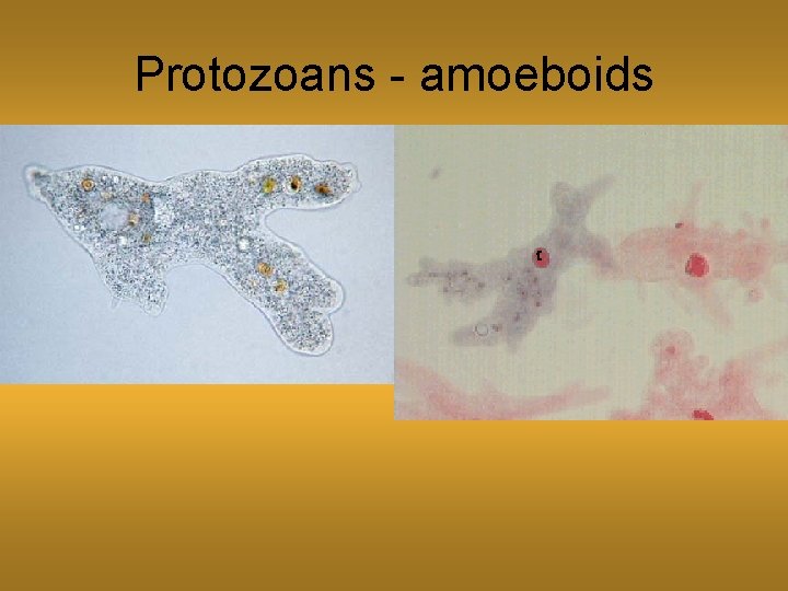 Protozoans - amoeboids 