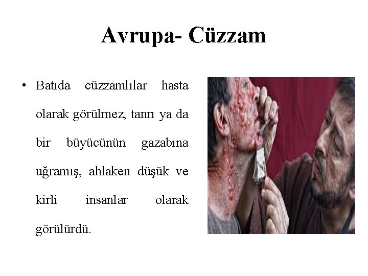 Avrupa- Cüzzam • Batıda cüzzamlılar hasta olarak görülmez, tanrı ya da bir büyücünün gazabına