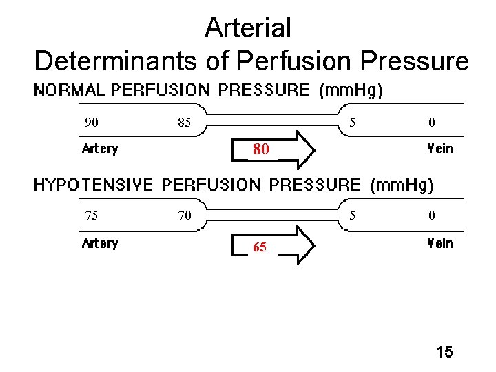 Arterial Determinants of Perfusion Pressure 90 85 5 0 80 75 70 65 15