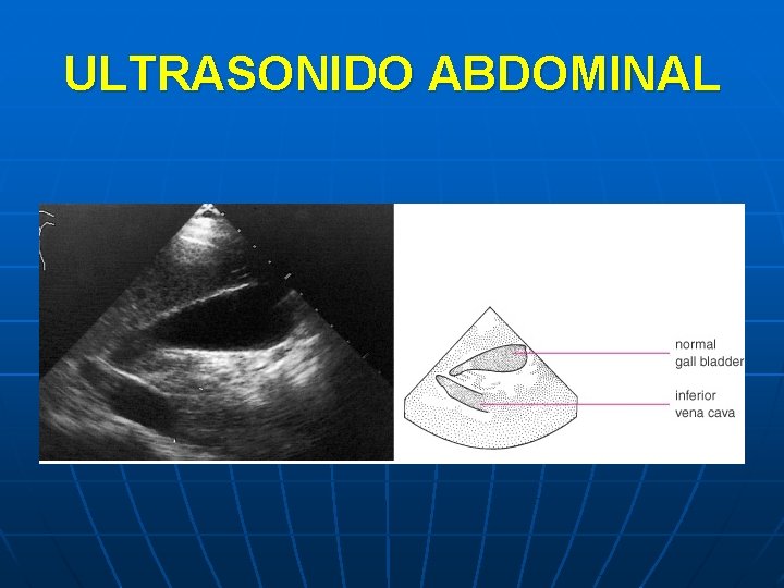 ULTRASONIDO ABDOMINAL 