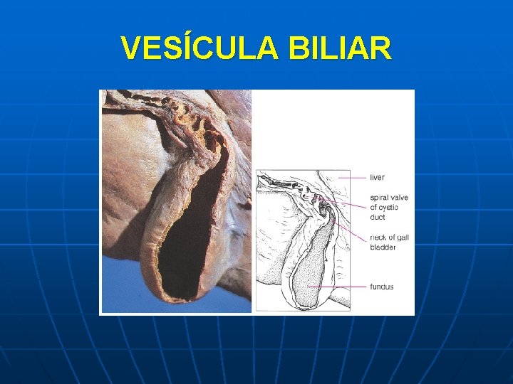 VESÍCULA BILIAR 