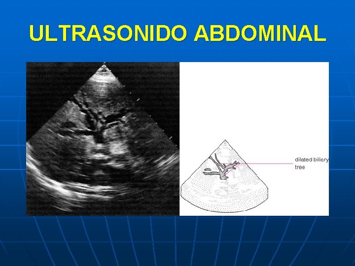 ULTRASONIDO ABDOMINAL 