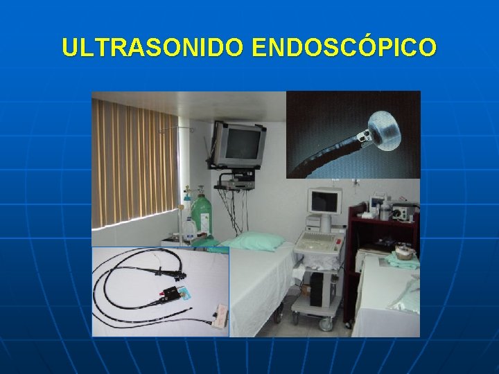 ULTRASONIDO ENDOSCÓPICO 