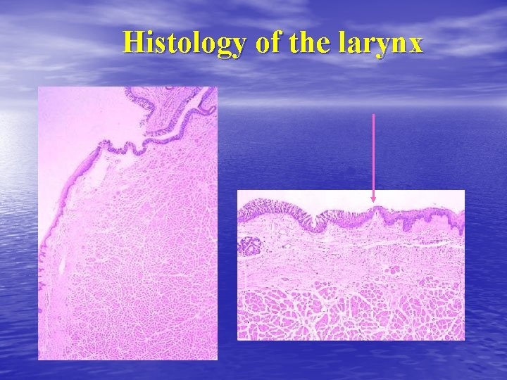 Histology of the larynx 