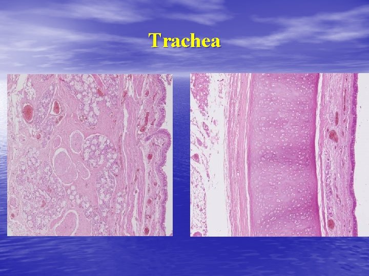 Trachea 
