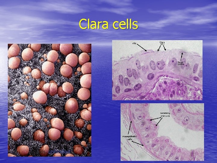 Clara cells 