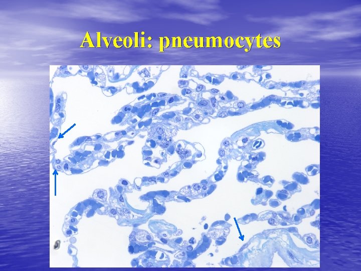 Alveoli: pneumocytes 