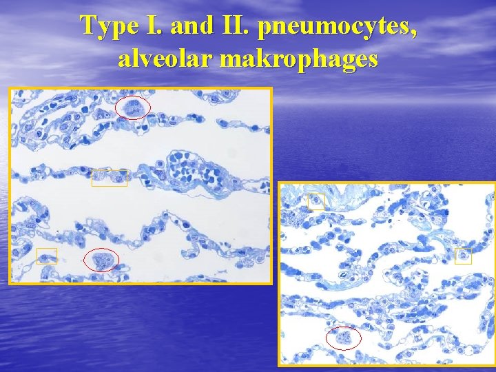 Type I. and II. pneumocytes, alveolar makrophages 