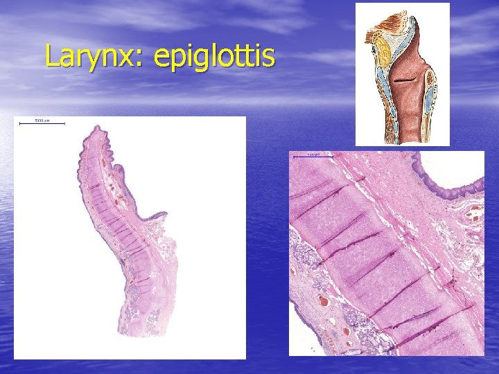Larynx: epiglottis 