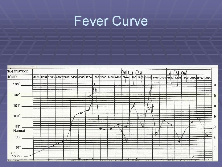 Fever Curve 