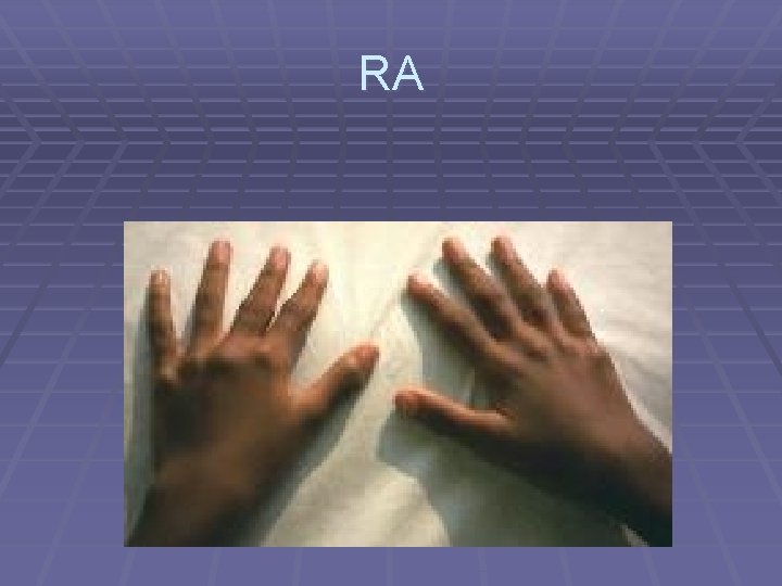 RA 