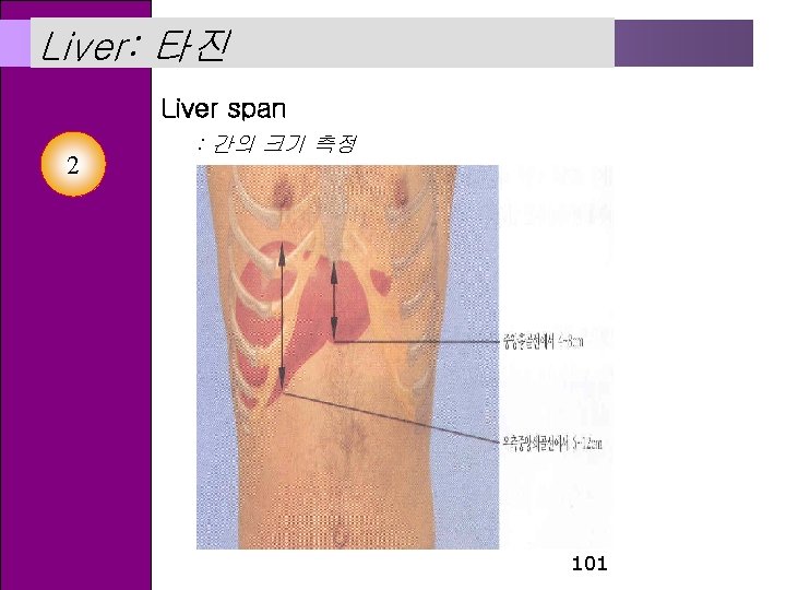 Liver: 타진 Liver span 2 : 간의 크기 측정 101 