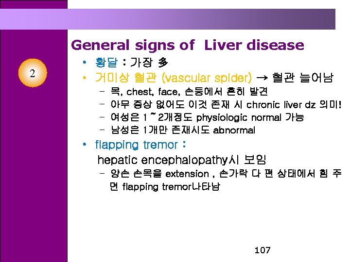 General signs of Liver disease 2 • 황달 : 가장 多 • 거미상 혈관