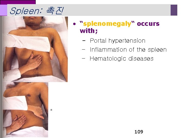 Spleen: 촉진 • “splenomegaly“ occurs with; 2 – Portal hypertension – Inflammation of the