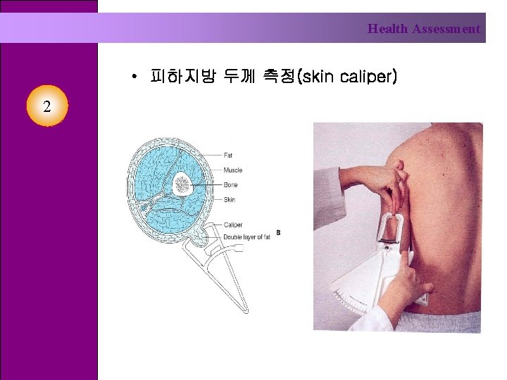 Health Assessment • 피하지방 두께 측정(skin caliper) 2 