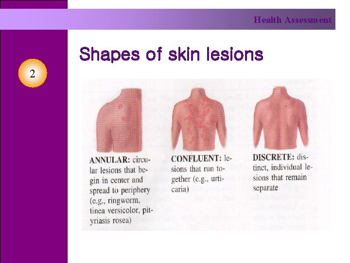 Health Assessment Shapes of skin lesions 2 