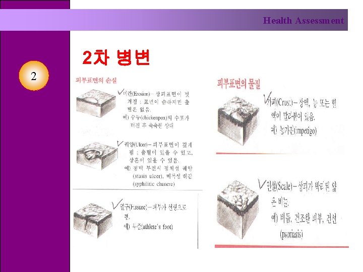 Health Assessment 2차 병변 2 