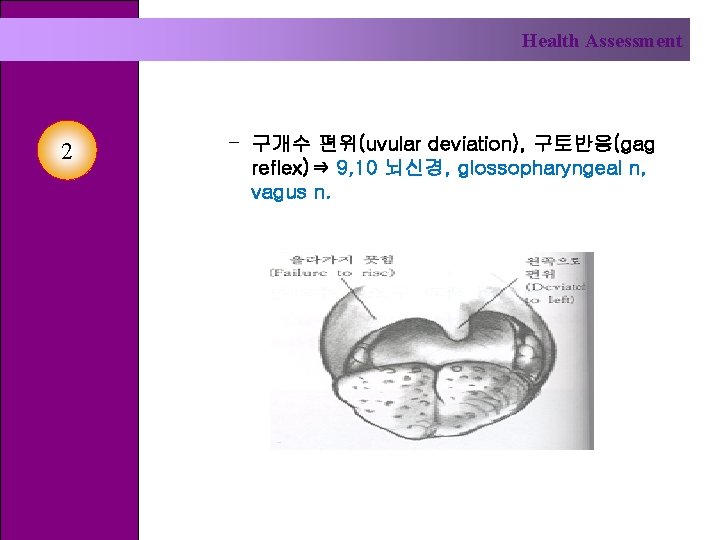 Health Assessment 2 – 구개수 편위(uvular deviation), 구토반응(gag reflex)⇒ 9, 10 뇌신경, glossopharyngeal n,