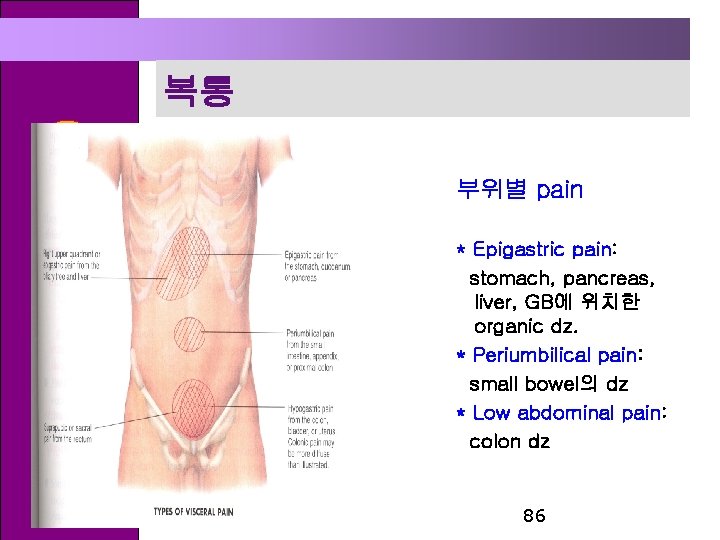 복통 2 부위별 pain * Epigastric pain: stomach, pancreas, liver, GB에 위치한 organic dz.