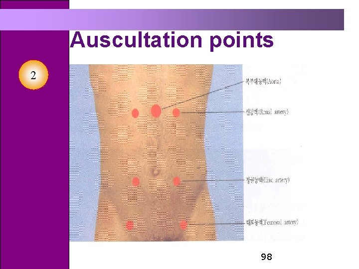 Auscultation points 2 98 