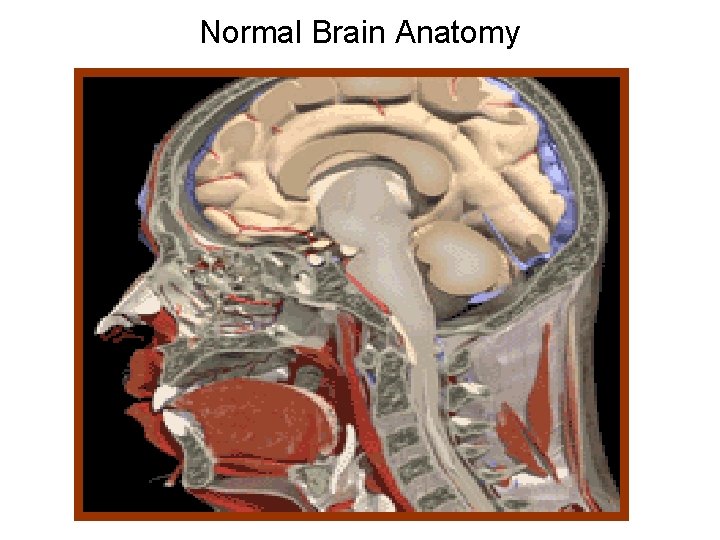 Normal Brain Anatomy 