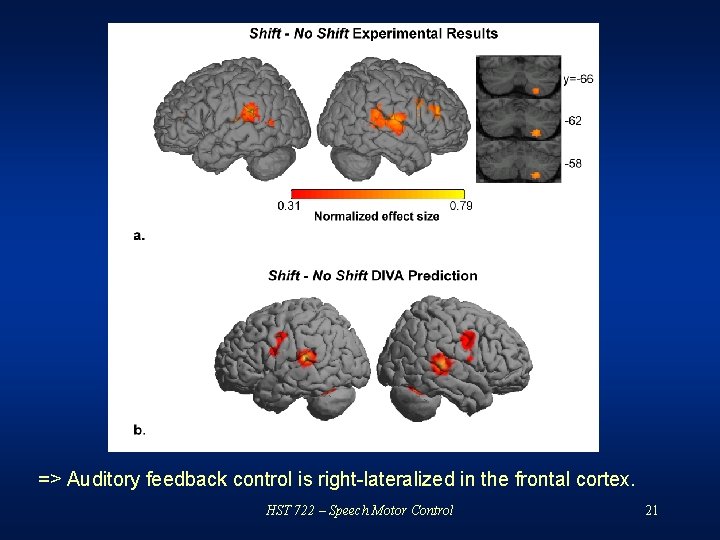 => Auditory feedback control is right-lateralized in the frontal cortex. HST 722 – Speech