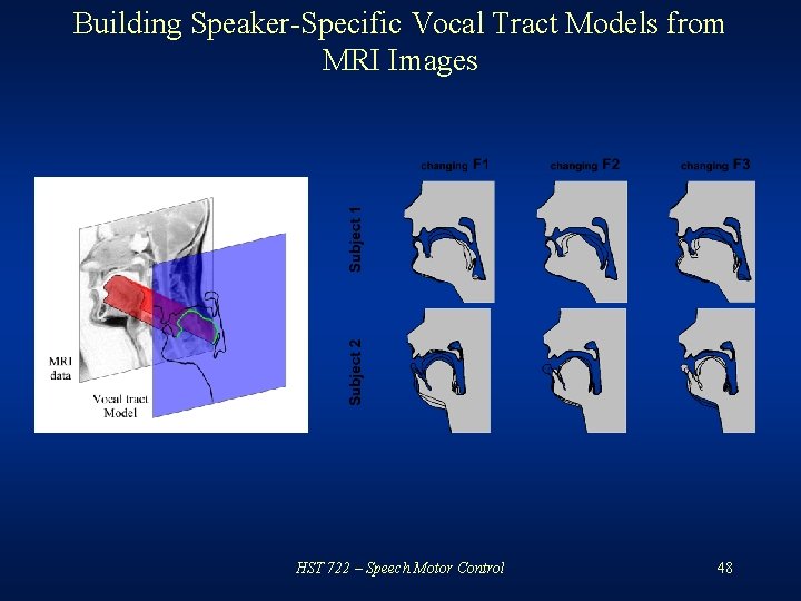 Building Speaker-Specific Vocal Tract Models from MRI Images HST 722 – Speech Motor Control