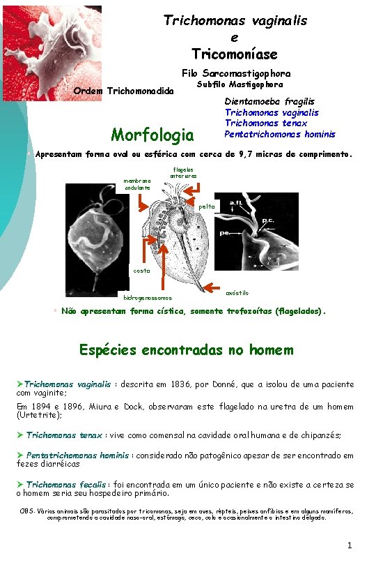 Trichomonas vaginalis e Tricomoníase Filo Sarcomastigophora Ordem Trichomonadida Subfilo Mastigophora Dientamoeba fragilis Trichomonas vaginalis