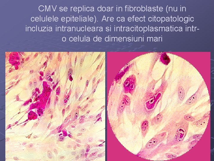 CMV se replica doar in fibroblaste (nu in celulele epiteliale). Are ca efect citopatologic