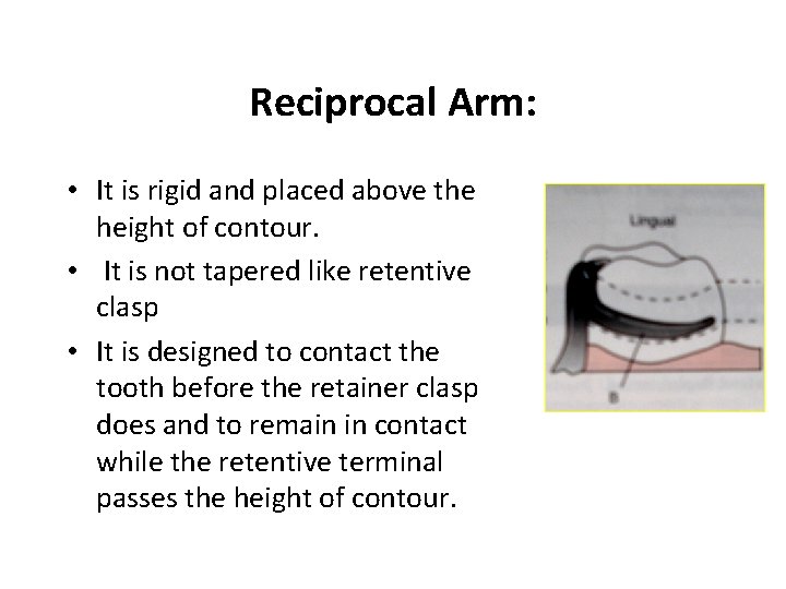 Reciprocal Arm: • It is rigid and placed above the height of contour. •