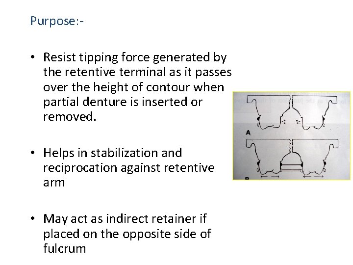 Purpose: - • Resist tipping force generated by the retentive terminal as it passes