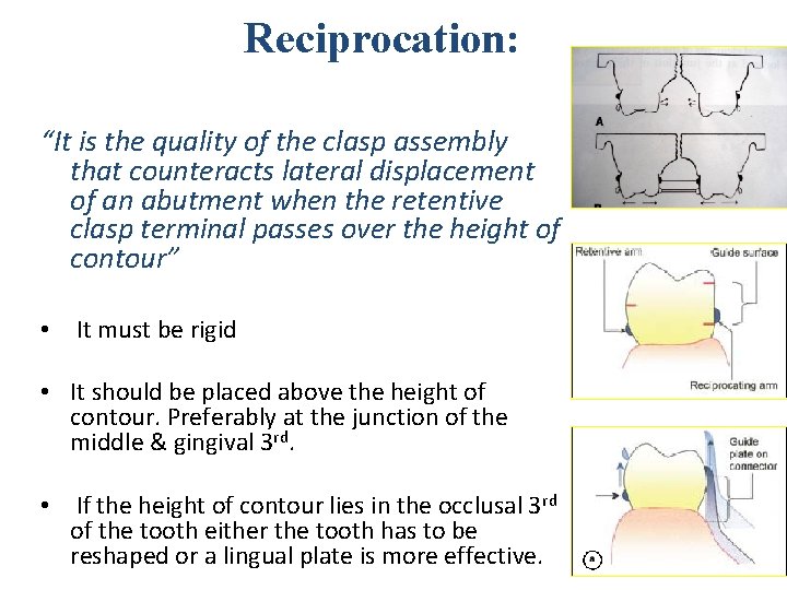 Reciprocation: “It is the quality of the clasp assembly that counteracts lateral displacement of