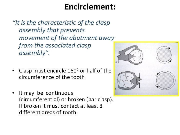 Encirclement: “It is the characteristic of the clasp assembly that prevents movement of the