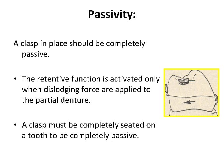 Passivity: A clasp in place should be completely passive. • The retentive function is