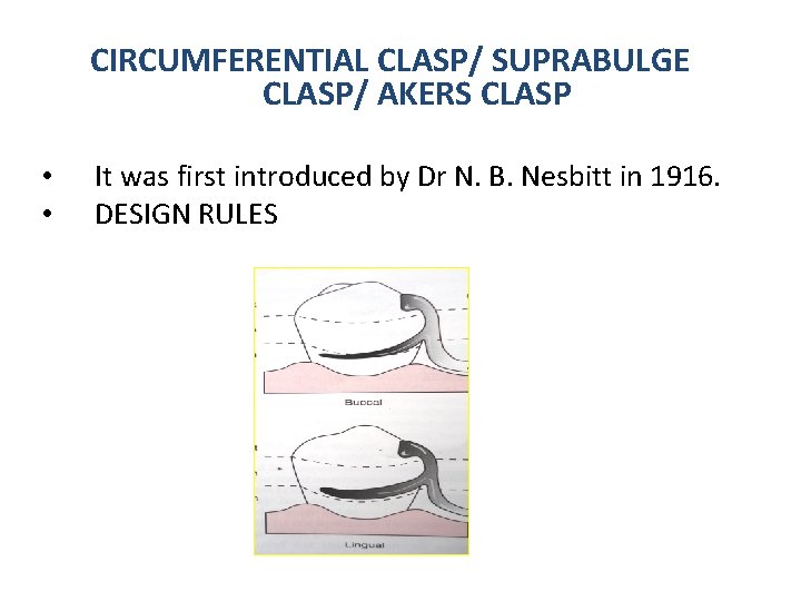 CIRCUMFERENTIAL CLASP/ SUPRABULGE CLASP/ AKERS CLASP • • It was first introduced by Dr