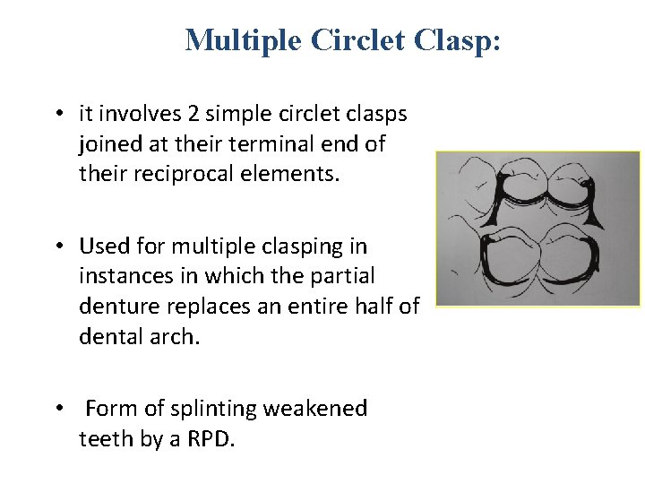Multiple Circlet Clasp: • it involves 2 simple circlet clasps joined at their terminal
