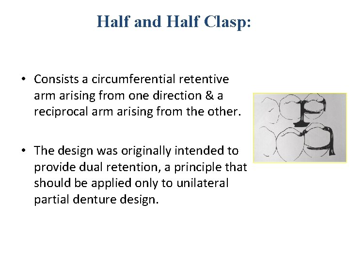 Half and Half Clasp: • Consists a circumferential retentive arm arising from one direction