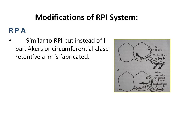 Modifications of RPI System: R P A • Similar to RPI but instead of