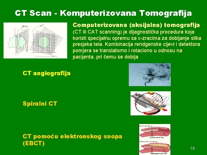 CT Scan - Komputerizovana Tomografija Computerizovana (aksijalna) tomografija (CT ili CAT scanning) je dijagnostička