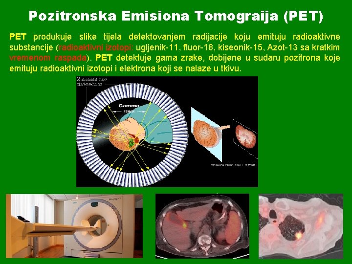 Pozitronska Emisiona Tomograija (PET) PET produkuje slike tijela detektovanjem radijacije koju emituju radioaktivne substancije