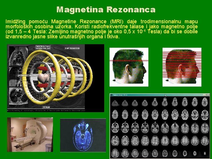 Magnetina Rezonanca Imidžing pomoću Magnetine Rezonance (MRI) daje trodimensionalnu mapu morfoloških osobina uzorka. Koristi