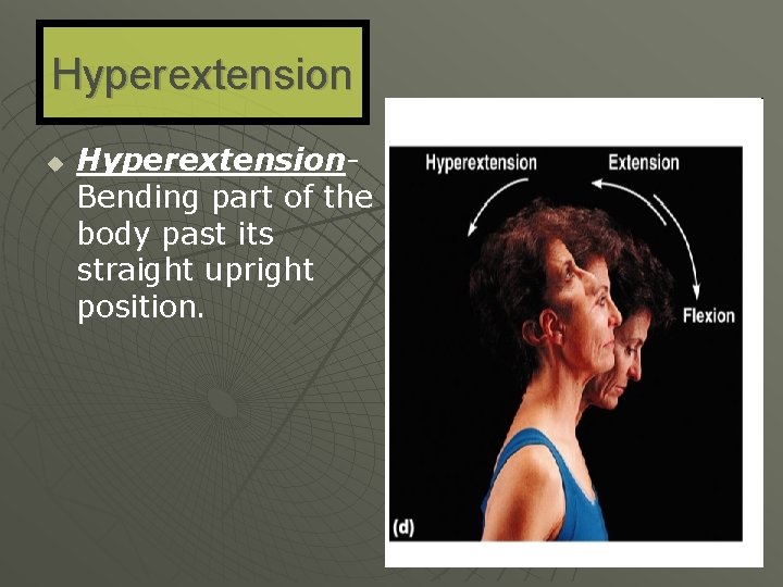 Hyperextension u Hyperextension- Bending part of the body past its straight upright position. 