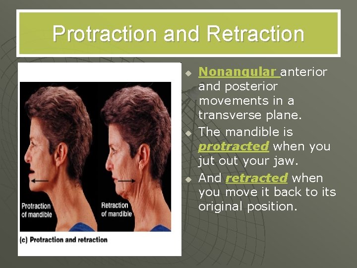 Protraction and Retraction u u u Nonangular anterior and posterior movements in a transverse