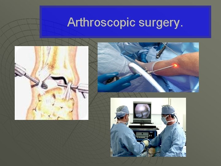 Arthroscopic surgery. 