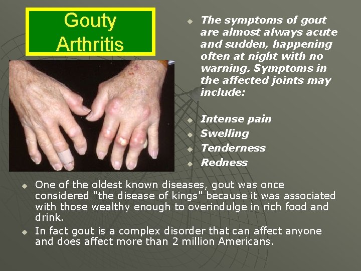 Gouty Arthritis u u u u The symptoms of gout are almost always acute
