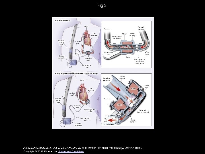 Fig 3 Journal of Cardiothoracic and Vascular Anesthesia 2018 321001 -1012 DOI: (10. 1053/j. Fig 3 Journal of Cardiothoracic and Vascular Anesthesia 2018 321001 -1012 DOI: (10. 1053/j.