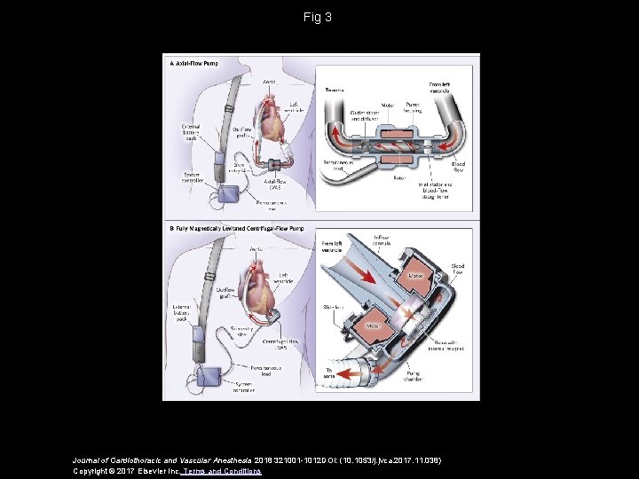 Fig 3 Journal of Cardiothoracic and Vascular Anesthesia 2018 321001 -1012 DOI: (10. 1053/j.