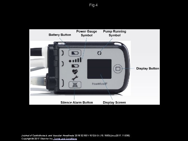Fig 4 Journal of Cardiothoracic and Vascular Anesthesia 2018 321001 -1012 DOI: (10. 1053/j. Fig 4 Journal of Cardiothoracic and Vascular Anesthesia 2018 321001 -1012 DOI: (10. 1053/j.